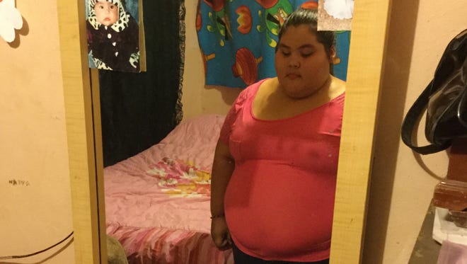 Dayana está marcada por un exceso de peso que condiciona su día a día y es un ejemplo más del grave problema de la obesidad en México.