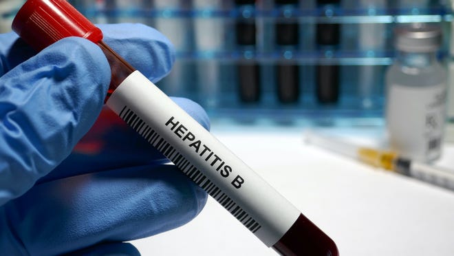 Prueba de hepatitis